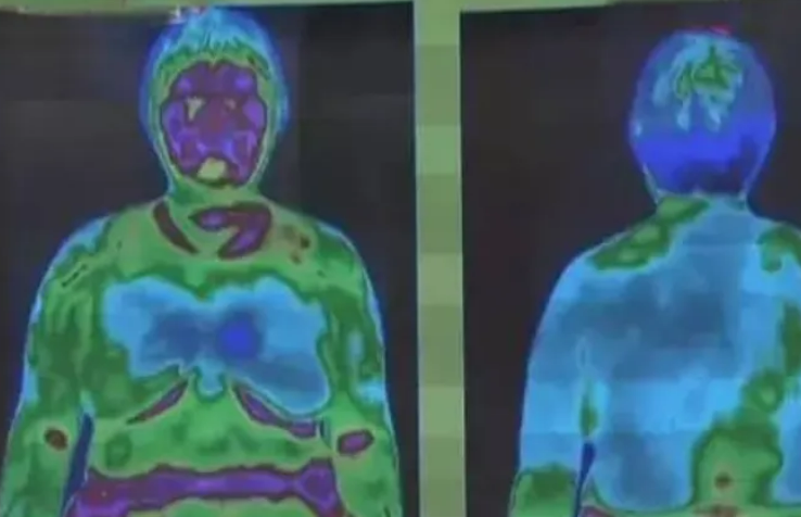 紅外熱成像儀檢查：身體健康狀況如何，只需一掃就能全看清